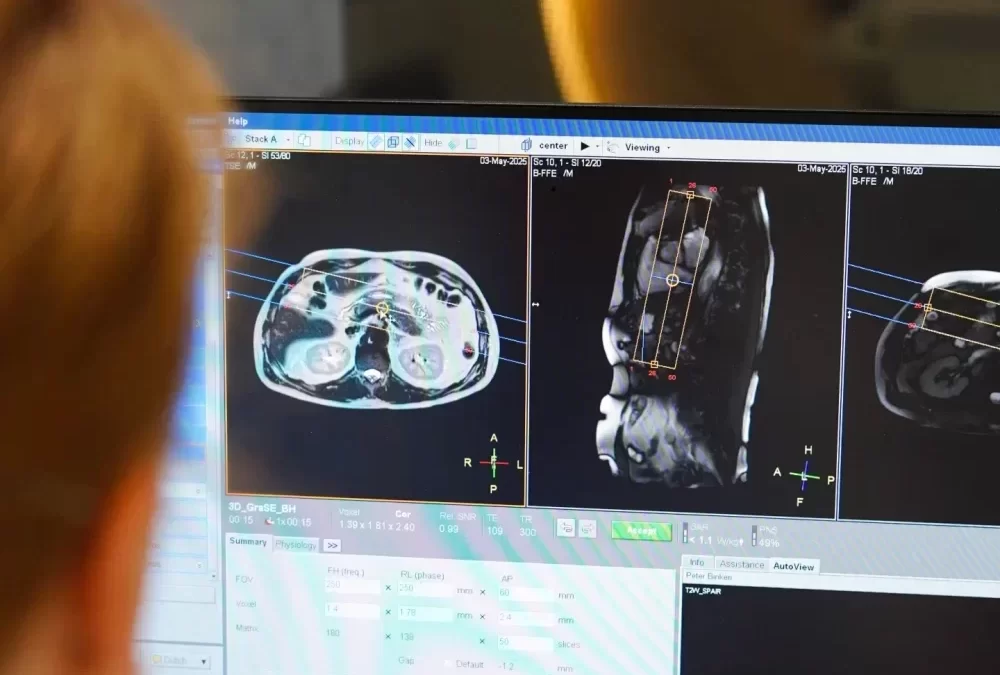Bij ScanClinic is AI de standaard