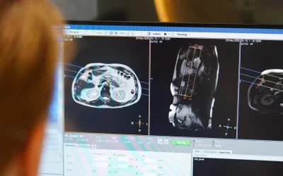 Bij ScanClinic is AI de standaard