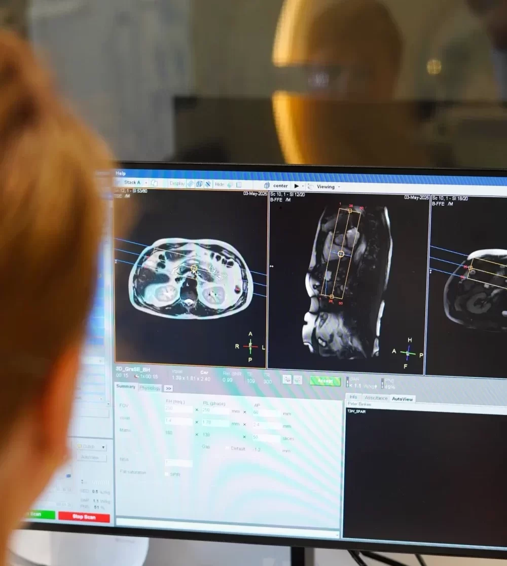 MRI-beelden tijdens medische analyse