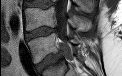Zo bereidt u zich voor op uw MRI-scan