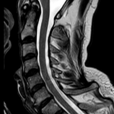 MRI Essential bij ScanClinic