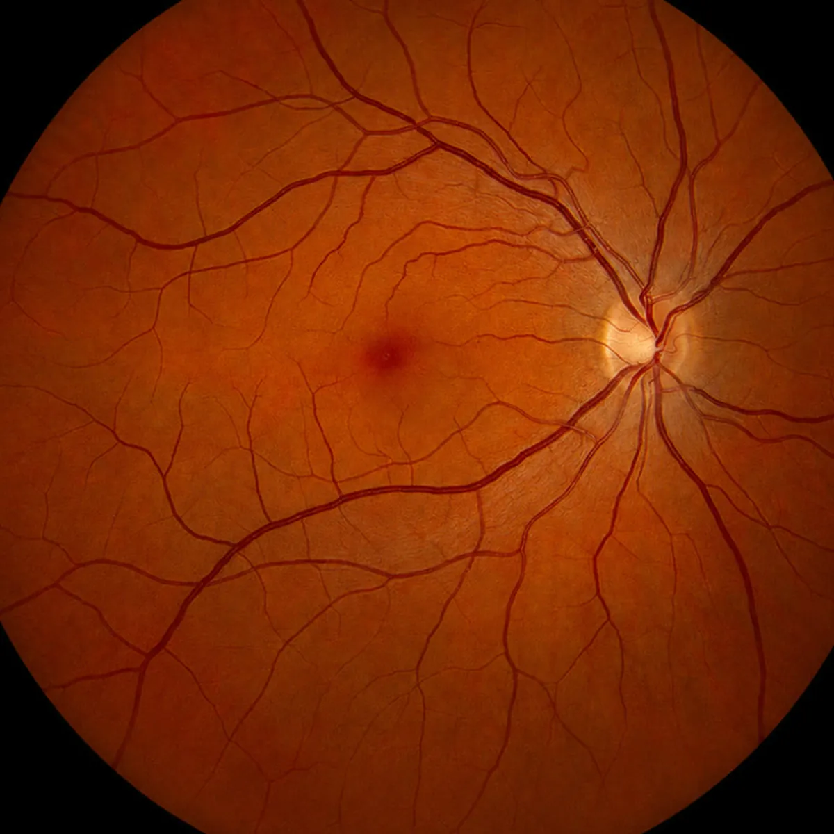 Netvliesfoto gebruikt voor de AI-RetinaScan